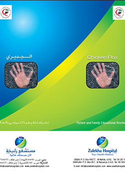 https://beta1.zulekhahospitals.com/uploads/leaflets_cover/13What-is-chickenpox.jpg