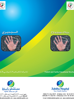 https://beta1.zulekhahospitals.com/uploads/leaflets_cover/16What-is-chickenpox.jpg