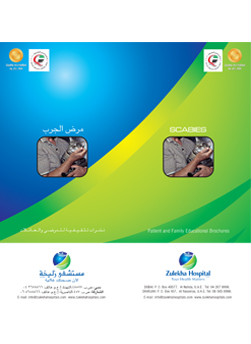 https://beta1.zulekhahospitals.com/uploads/leaflets_cover/2Scabies.jpg