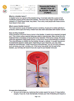 https://beta1.zulekhahospitals.com/uploads/leaflets_cover/32TURBT.jpg
